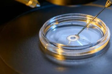 试管婴儿｜移植前子宫内膜的调理能有效提高试管成功率！