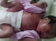 排卵障碍不容忽视，不孕大多是其原因！平顶山市哪家医院擅长排卵障碍试管方案？