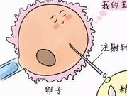 国内试管双胞胎费用全解析，价格清单+报销小贴士一次看明白